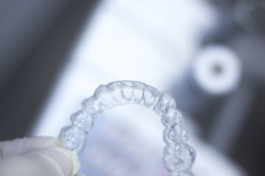 Görünmez diş aligner parantez