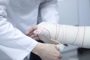 Doktor hasta alçı