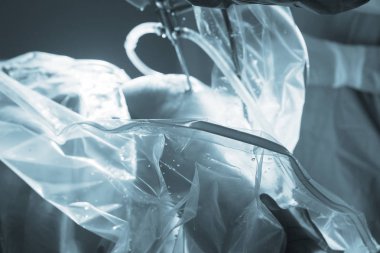 Diz cerrahisi Hastanesi işlemi