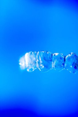 Görünmez diş aligner parantez