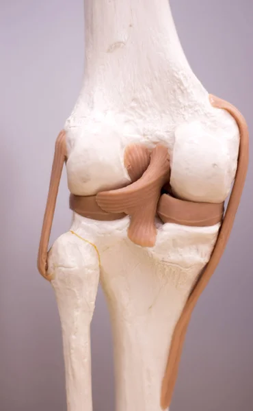 Medicínský model menisku kolena — Stock fotografie