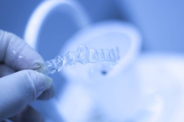 Görünmez diş aligner parantez