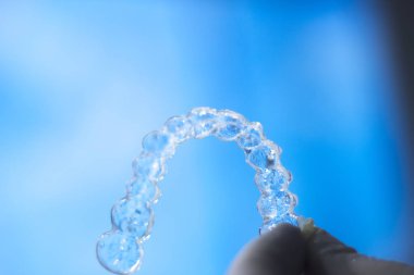 Görünmez diş aligner parantez