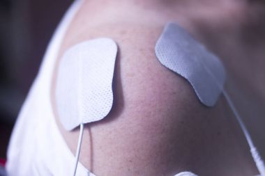 Fizik tedavi acupunture