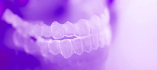 Zubní ortodontická vyrovnávač — Stock fotografie