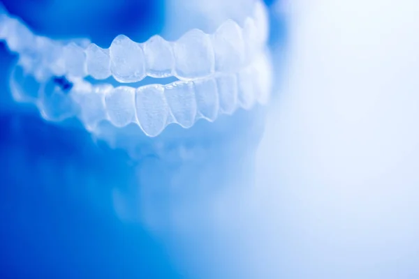 Allineatore ortodontico dentale — Foto Stock