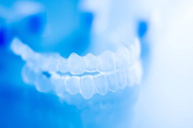 Ortodontik diş aligner