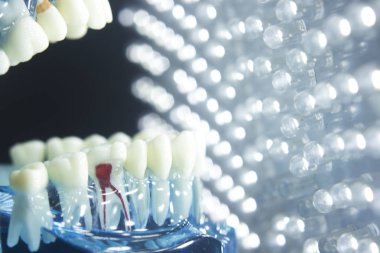 Diş diş modeli kök