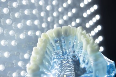 Diş hekimleri diş diş modeli