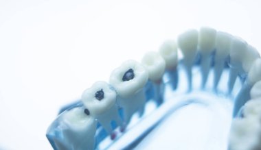 Diş hekimleri diş diş modeli