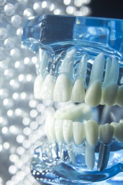 Diş hekimleri diş diş implant