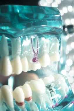 Diş diş modeli kök