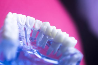 Diş hekimleri diş diş modeli