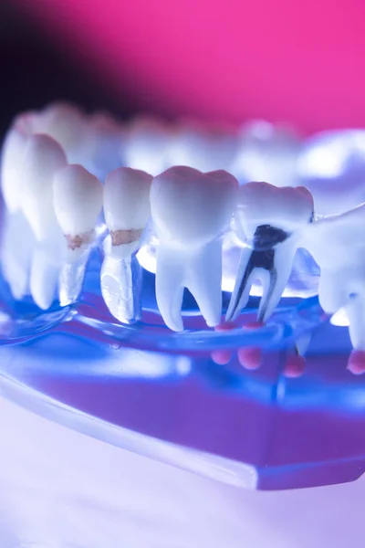 Canale dentale delle radici dentali — Foto Stock