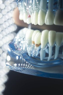 Diş hekimleri diş diş modeli