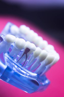 Diş hekimleri diş diş modeli