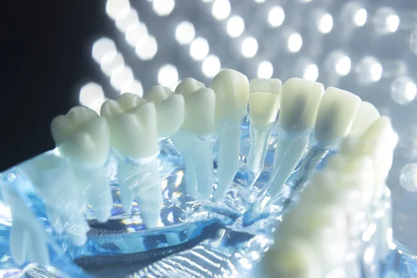 Dentistas modelo de dientes dentales — Foto de Stock