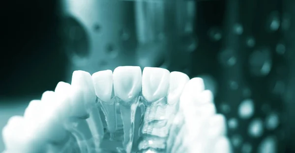 牙医牙科牙齿模型 — 图库照片