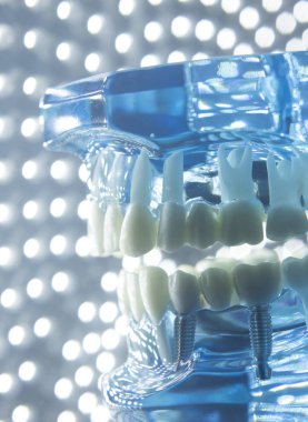 Diş hekimleri diş diş modeli