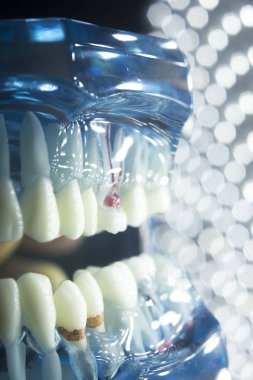 Diş diş modeli kök