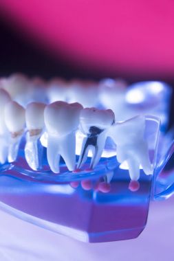 Diş hekimleri diş diş modeli