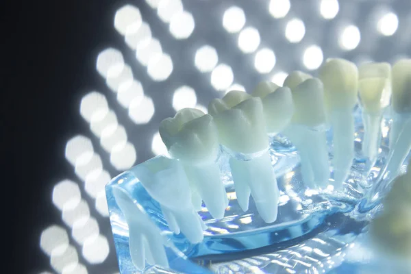 Dentysta dentystyczny zęby modelu — Zdjęcie stockowe