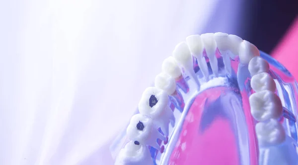 การสลายตัวของสุขภาพฟัน — ภาพถ่ายสต็อก
