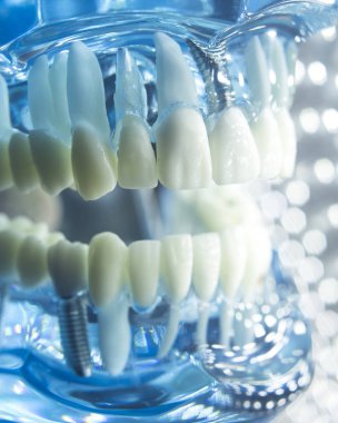 Diş hekimleri diş diş implant