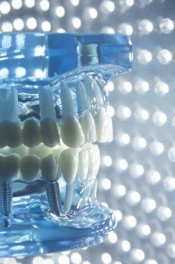 Diş hekimleri diş diş modeli