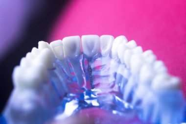 Diş hekimleri diş diş modeli