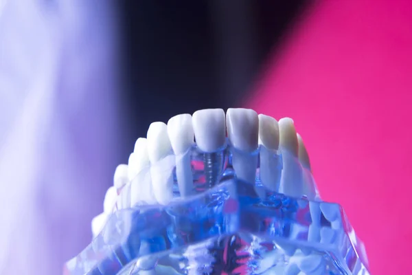 Tandartsen tandheelkundige tand model — Stockfoto
