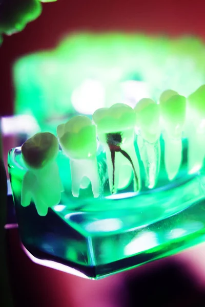Modelo de dentes dentários orais — Fotografia de Stock