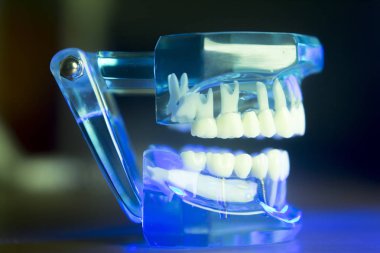 Diş diş klinik modeli