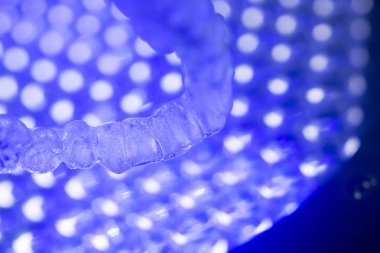 Görünmez diş aligners parantez