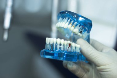 Diş diş diş Kliniği