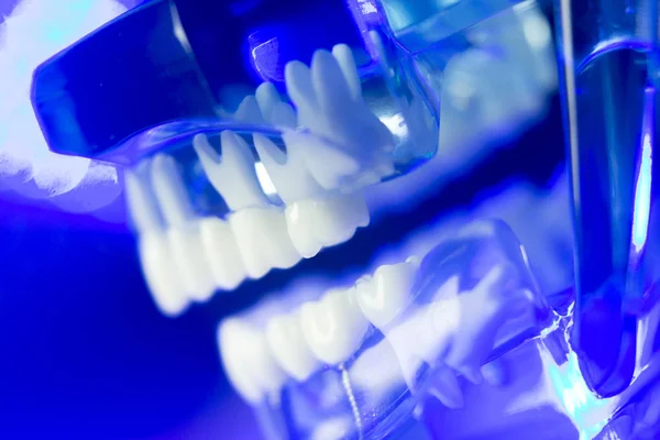 Modelo clínico de dientes dentales —  Fotos de Stock