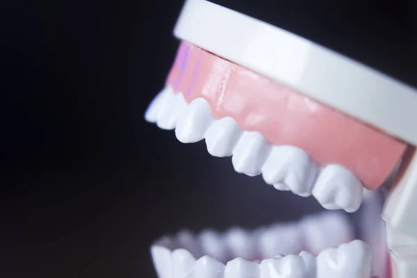 Dental teeth model — Stock Photo, Image