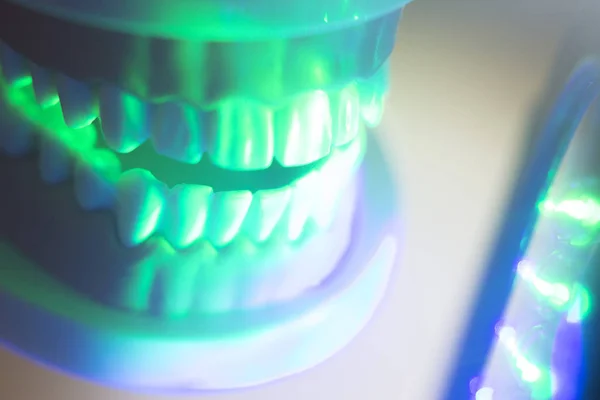 Tandheelkundige mondelinge tanden model — Stockfoto