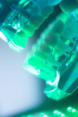 Diş ağız diş modeli