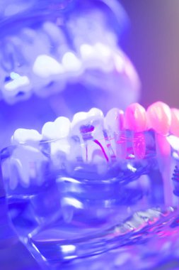 Diş sağlıklı diş modeli