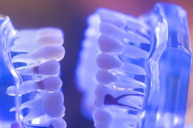 Diş diş çene modeli