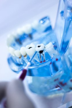 İnterdental Diş Temizleme