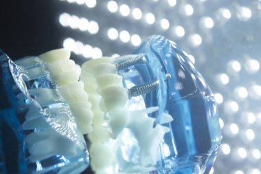 Diş hekimleri diş diş modeli