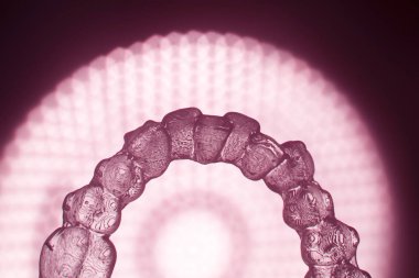 Görünmez diş aligner köşeli ayraç