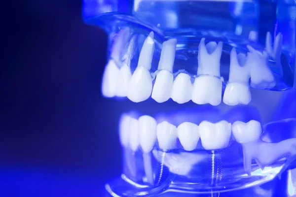 Klinicznych modelu zębów dentystycznych — Zdjęcie stockowe
