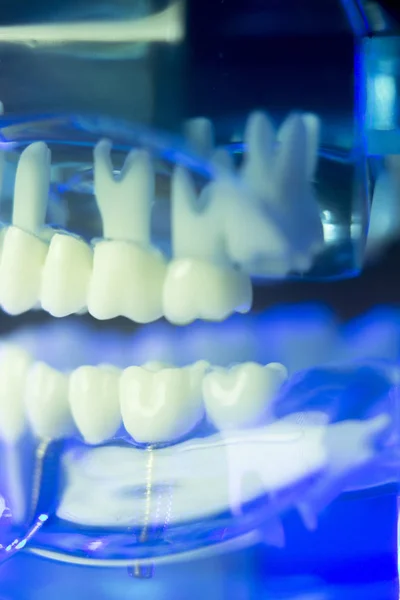 Modello clinico dentale dei denti — Foto Stock