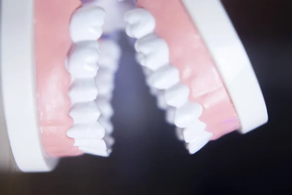 Dental teeth model — Stock Photo, Image