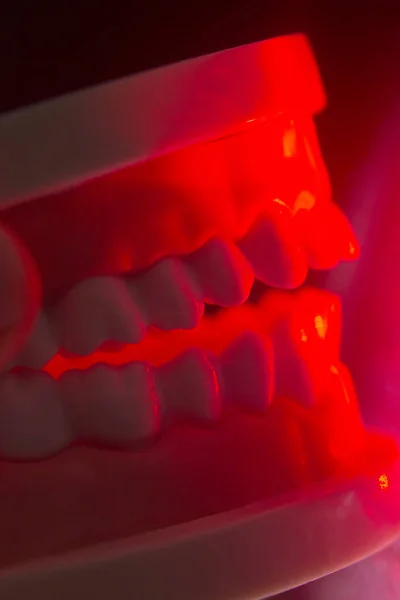 Modelo de mandíbula dental — Foto de Stock