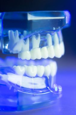 Diş diş klinik modeli