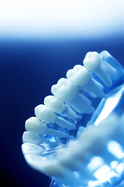 Model próchnicy zębów dentystycznych — Zdjęcie stockowe